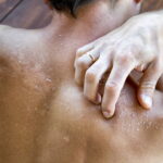 The Do’s and Don’ts of Healing a Sunburn