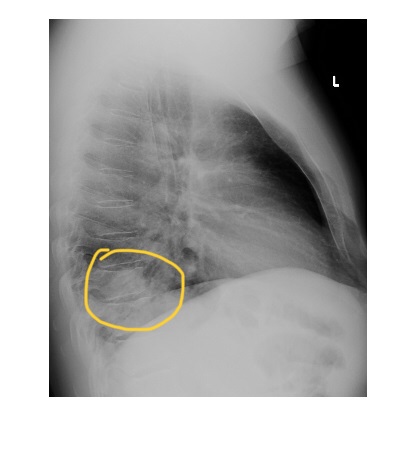 Imaging Case of the Week 498 Answer