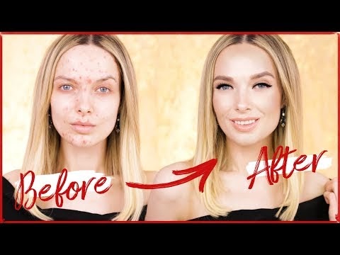 KENDALL JENNER ACNE COVERAGE MAKEUP TUTORIAL! // MyPaleSkin