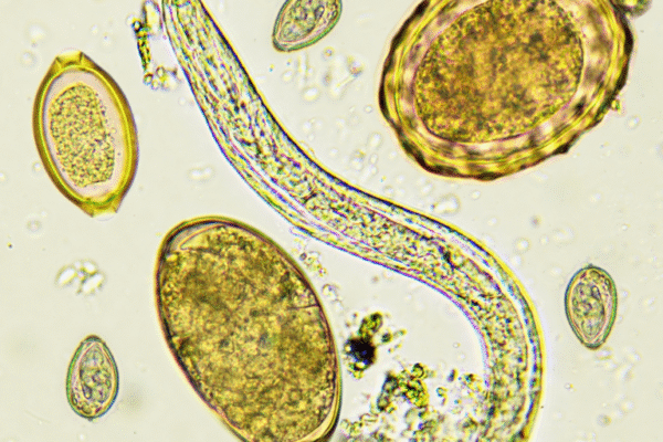 Are Parasites Wrecking Your Gut? Here’s What You Need to Know
