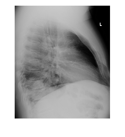 Imaging Case of the Week 498