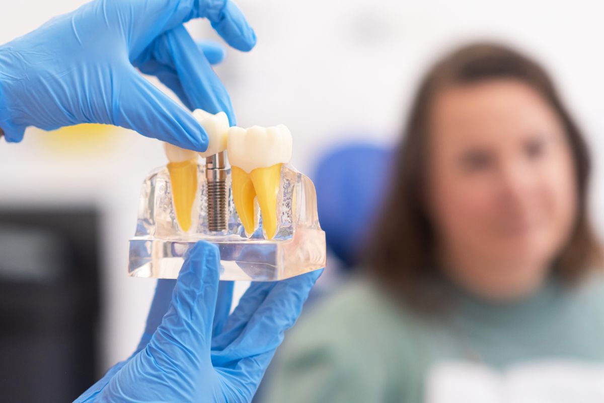 Choosing the Right Implant Dentist in Austin for Your Dental Needs