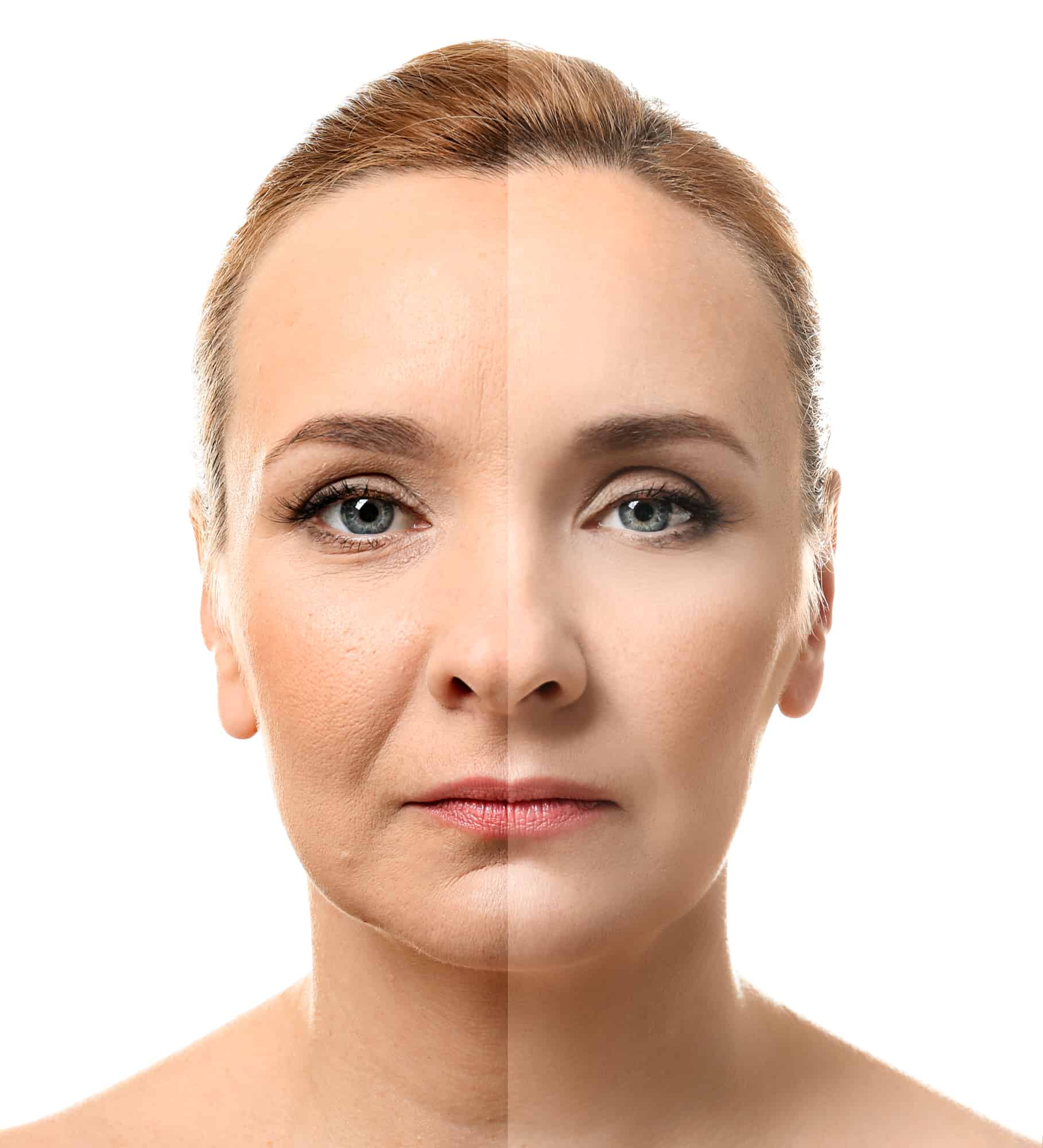 Why Hydrating And Moisturizing Is So Crucial For Mature Aging Skin?