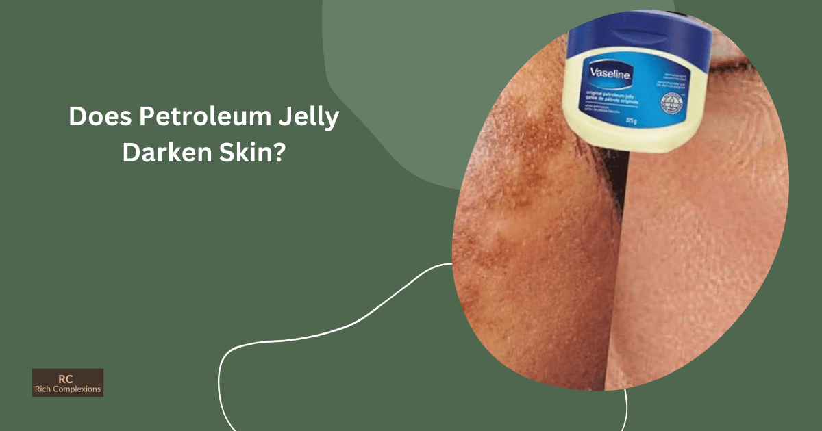 Does Petroleum Jelly Darken Skin? Know The Truth