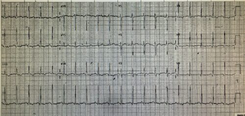 ECG of the Week 5th October 2022