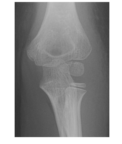 Imaging Case of the Week 508