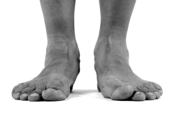 9 Tips to Self-Treat Posterior Tibialis Pain