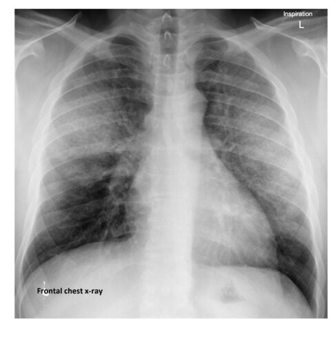 Imaging Case of the Week 499