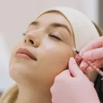 Health products watchdog ‘closely monitoring’ UK botulism cases linked to unlicenced Botox-like products