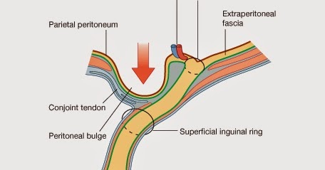 Paediatric Emergency Medicine: Testicular Torsion