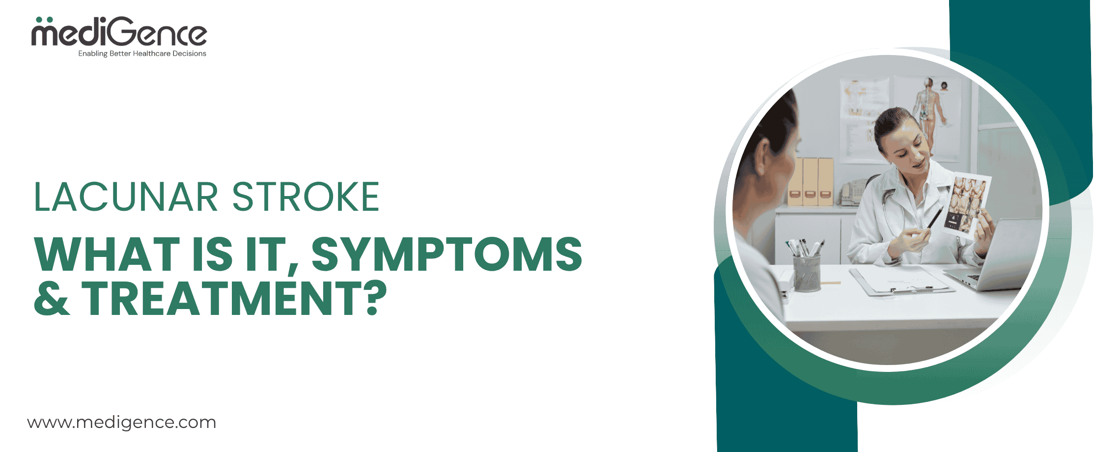 Lacunar Stroke – What Is It, Symptoms & Treatment?