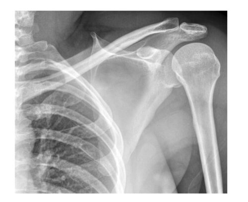 Imaging Case of the Week 506