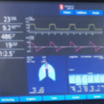 CCP Podcast: Episode 1 A short history of sedation in ICU