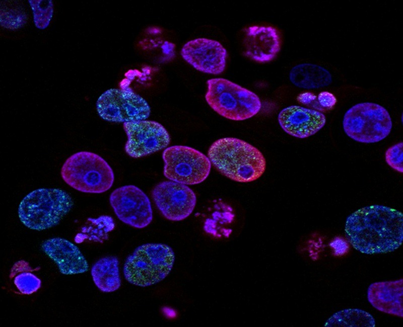 BMS Secures Health Canada approval for dual immunotherapy