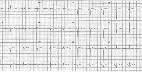 ECG of the Week 28/5/25