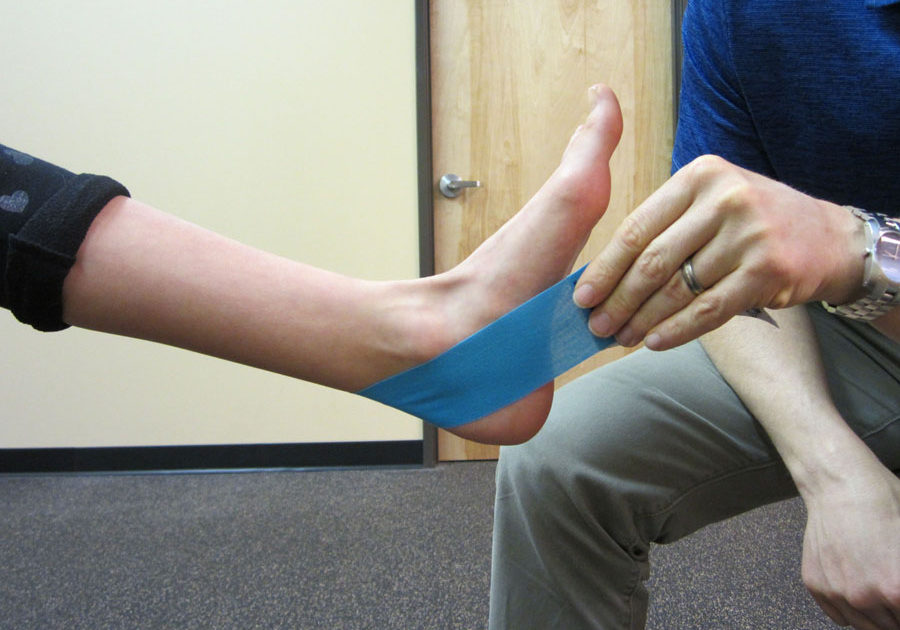 Taping for Posterior Tibialis Tendon Dysfunction (PTTD)