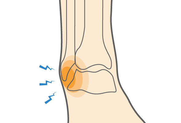 Injury Prevention Blog – Best Physio St Kilda