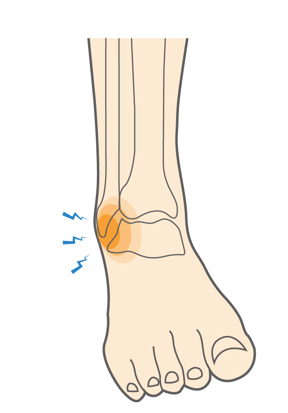 Injury Prevention Blog – Best Physio St Kilda
