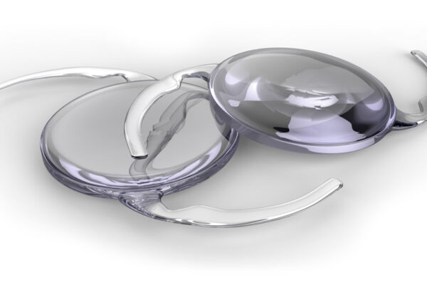 Cataract FAQ | Cataract Awareness Month