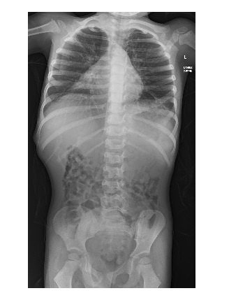 Imaging Case of the Week 486