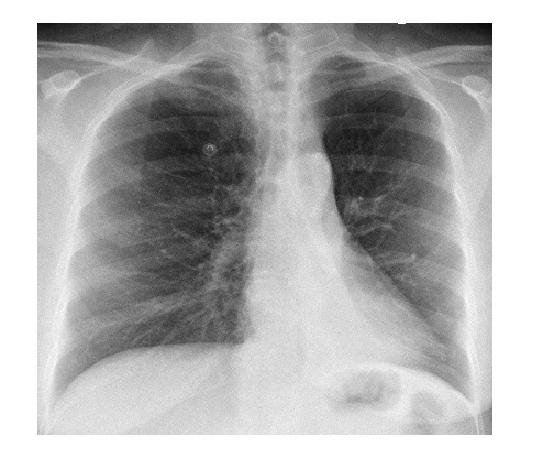 Imaging Case of the Week 530