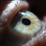 Neuropathic corneal pain reduced in phase 2 trial of urcosimod