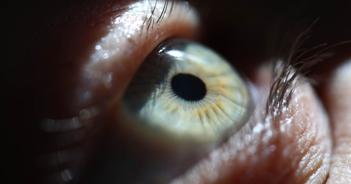 Neuropathic corneal pain reduced in phase 2 trial of urcosimod