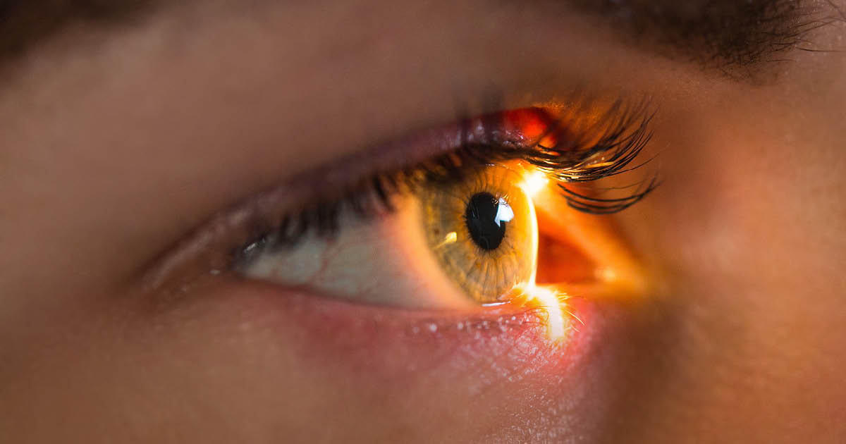 UK retrospective study: SLT by optometrists safe