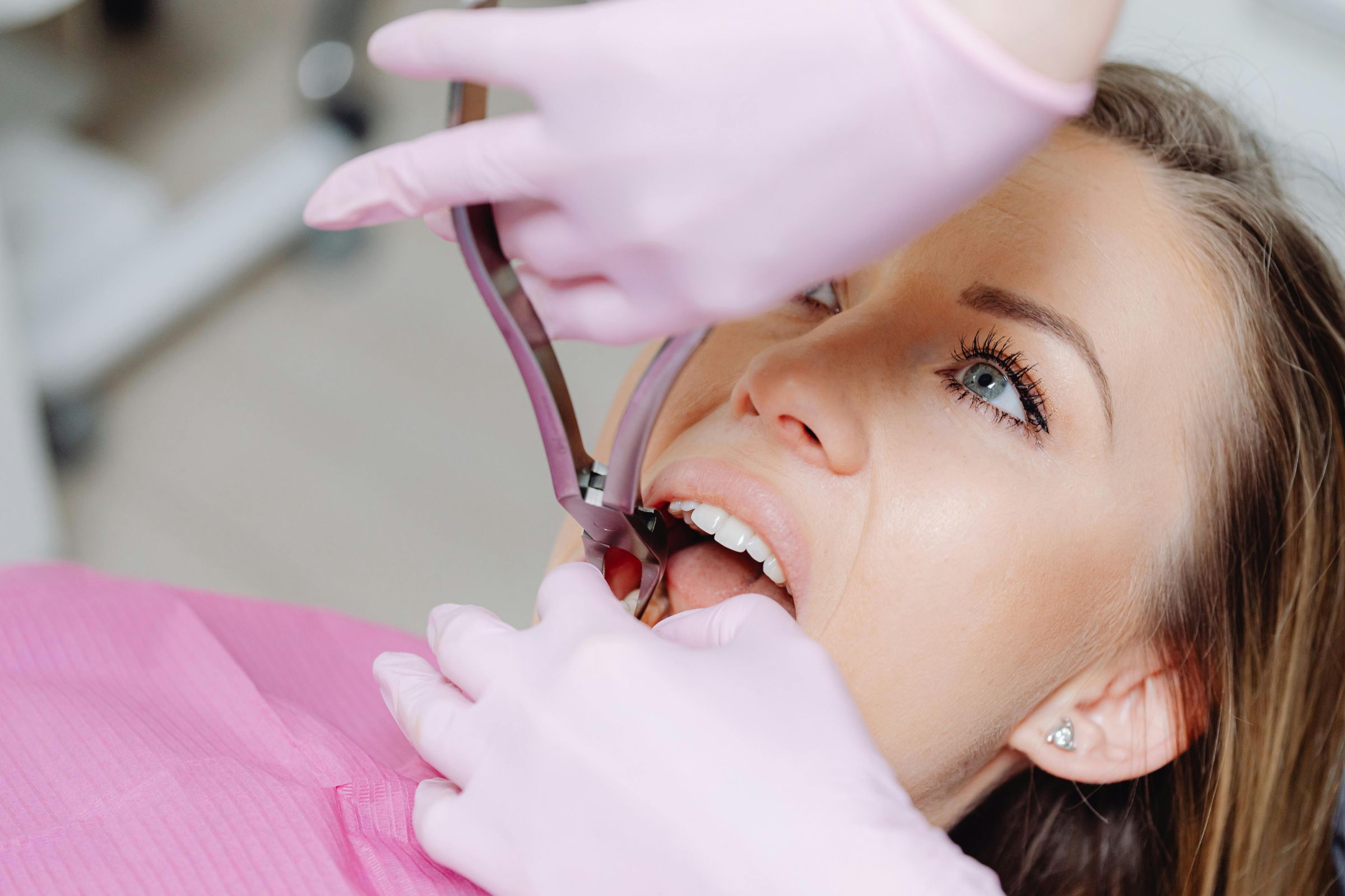 How All-on-8 Dental Implants Can Help You Get Your Smile Back