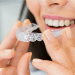 What to Expect From Culver City Invisalign Treatment