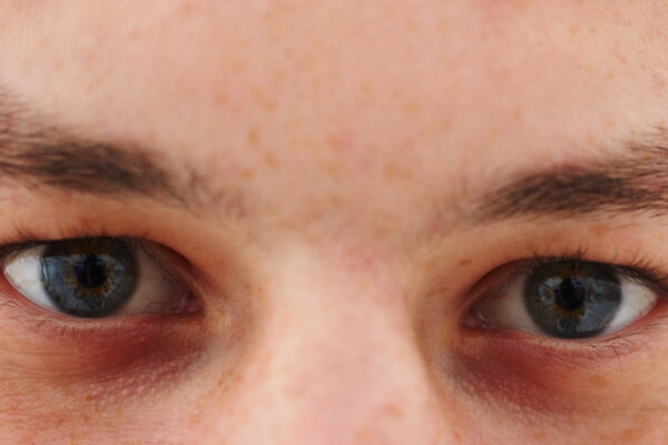 Promoting Healthy Eyes and Vision in Men | Men’s Health Month