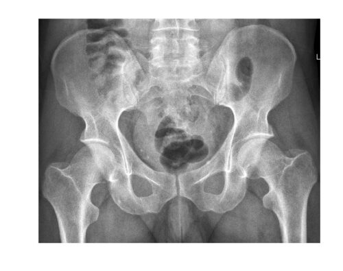 Imaging Case of the Week 522