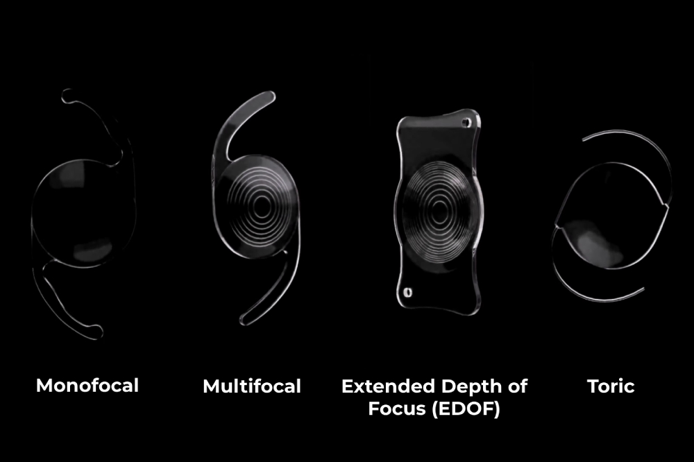 What Are The 4 Types of Cataract Lenses?