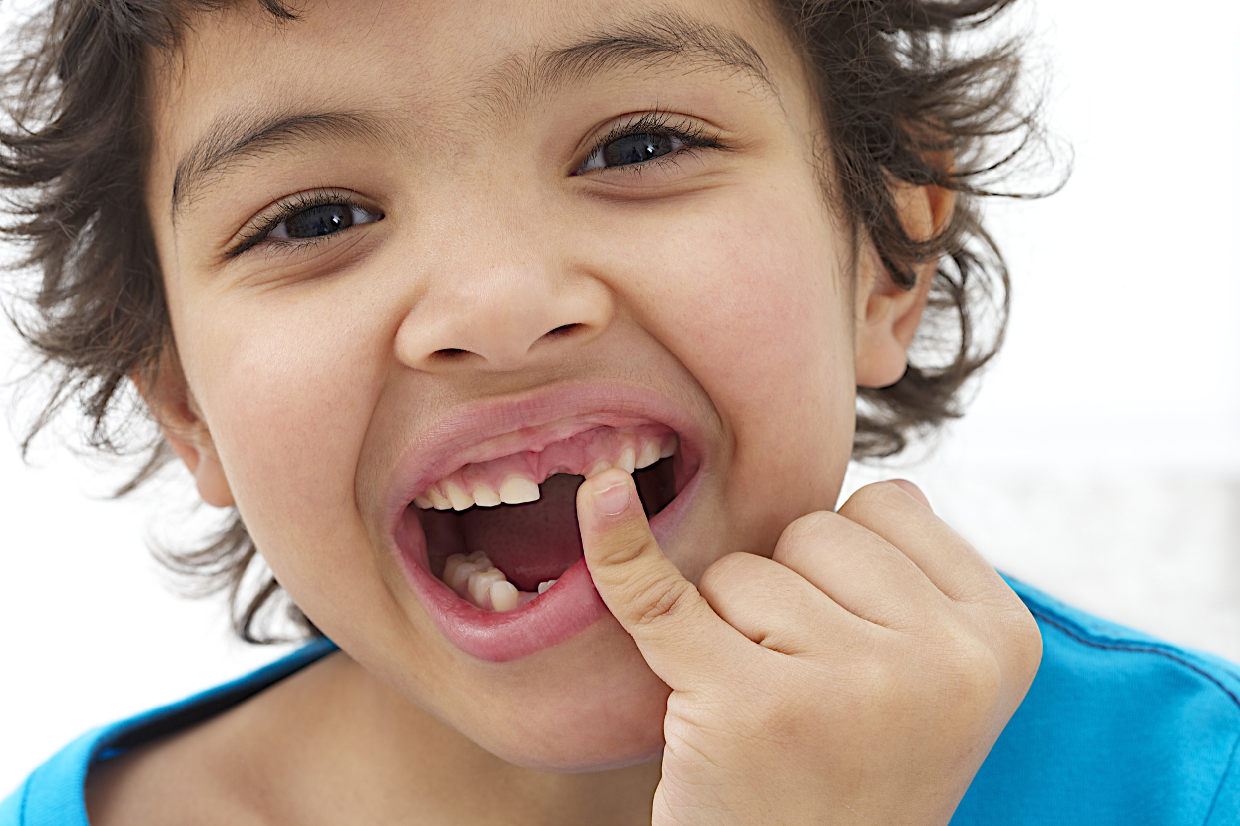 What to Do When Your Child Is Missing a Tooth