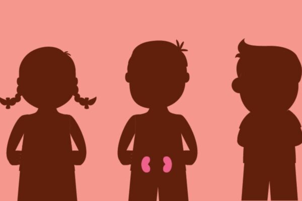 Urinary NGAL useful Biomarker for differentiating SRNS vs SSNS, reports study