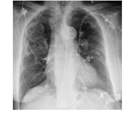 Imaging Case of the Week 460