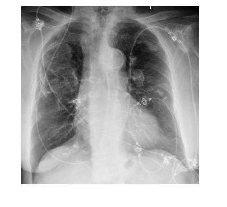 Imaging Case of the Week 460