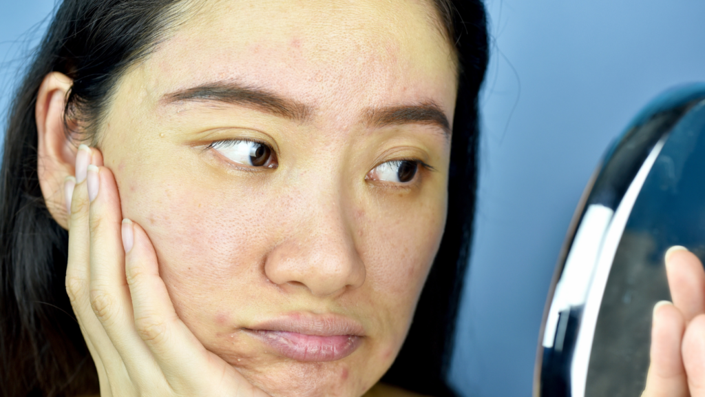What Skin Cells Really Do? And How Your Skincare Routine Affects Them