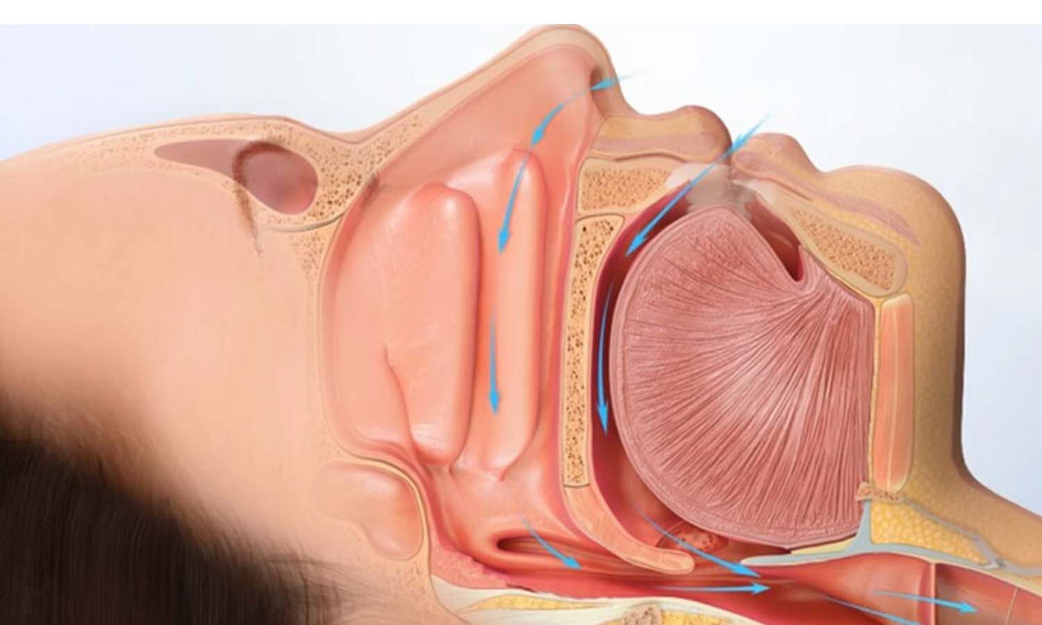 Undiagnosed Sleep-Disordered Breathing Worsens Heart Function in HCM Patients: JAMA