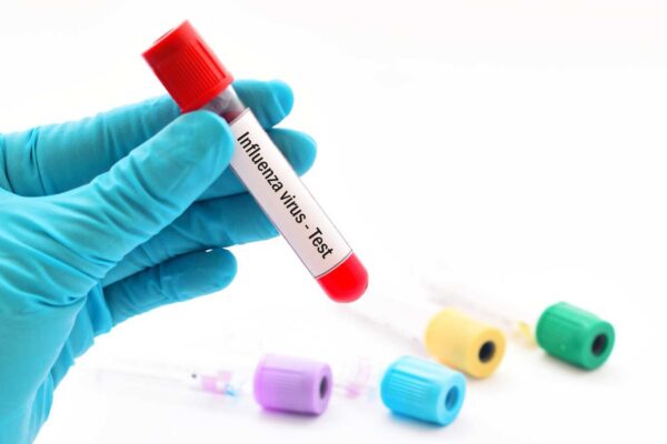 Oseltamivir therapy for influenza reduces the risk of severe influenza treatment events: JAMA