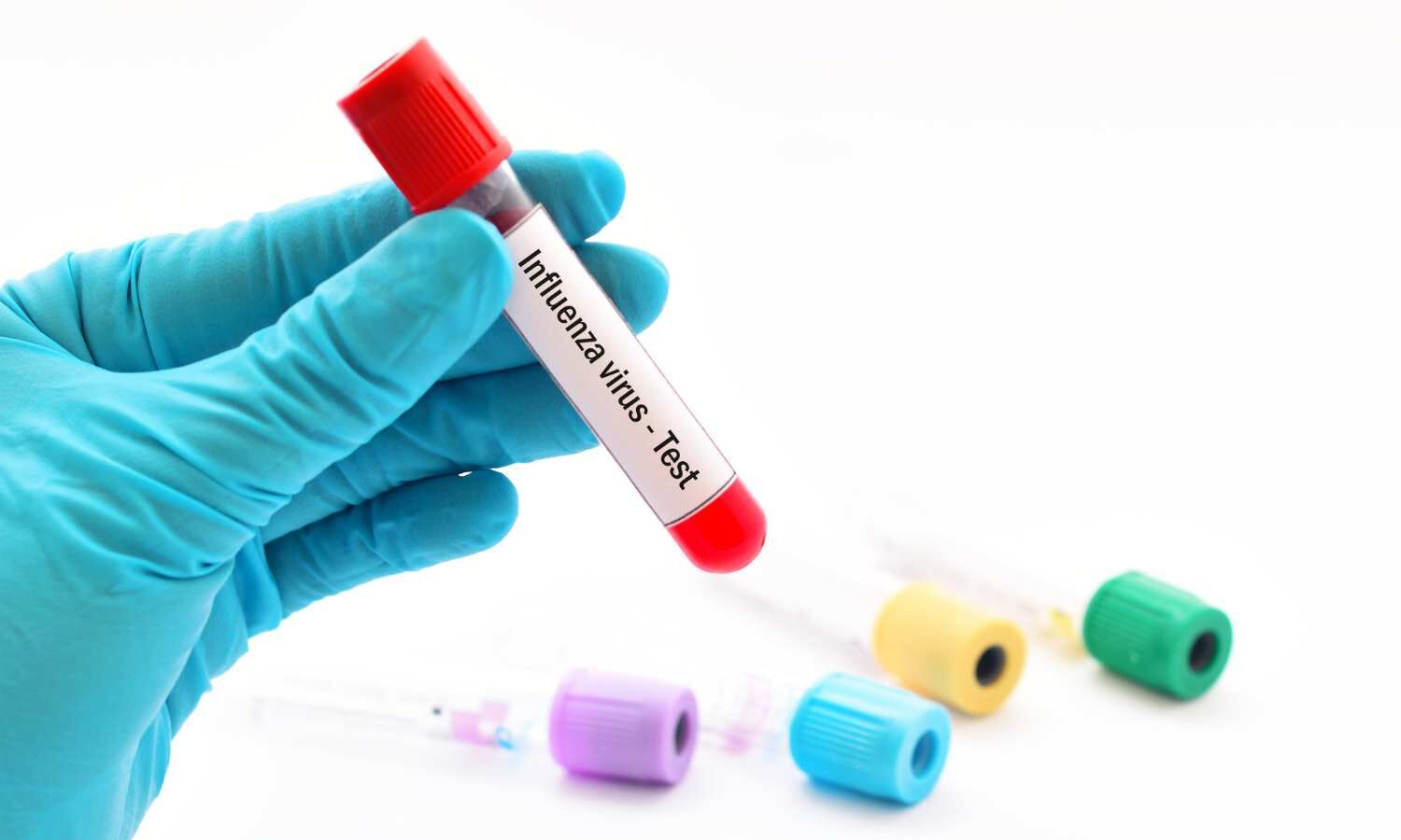 Oseltamivir therapy for influenza reduces the risk of severe influenza treatment events: JAMA