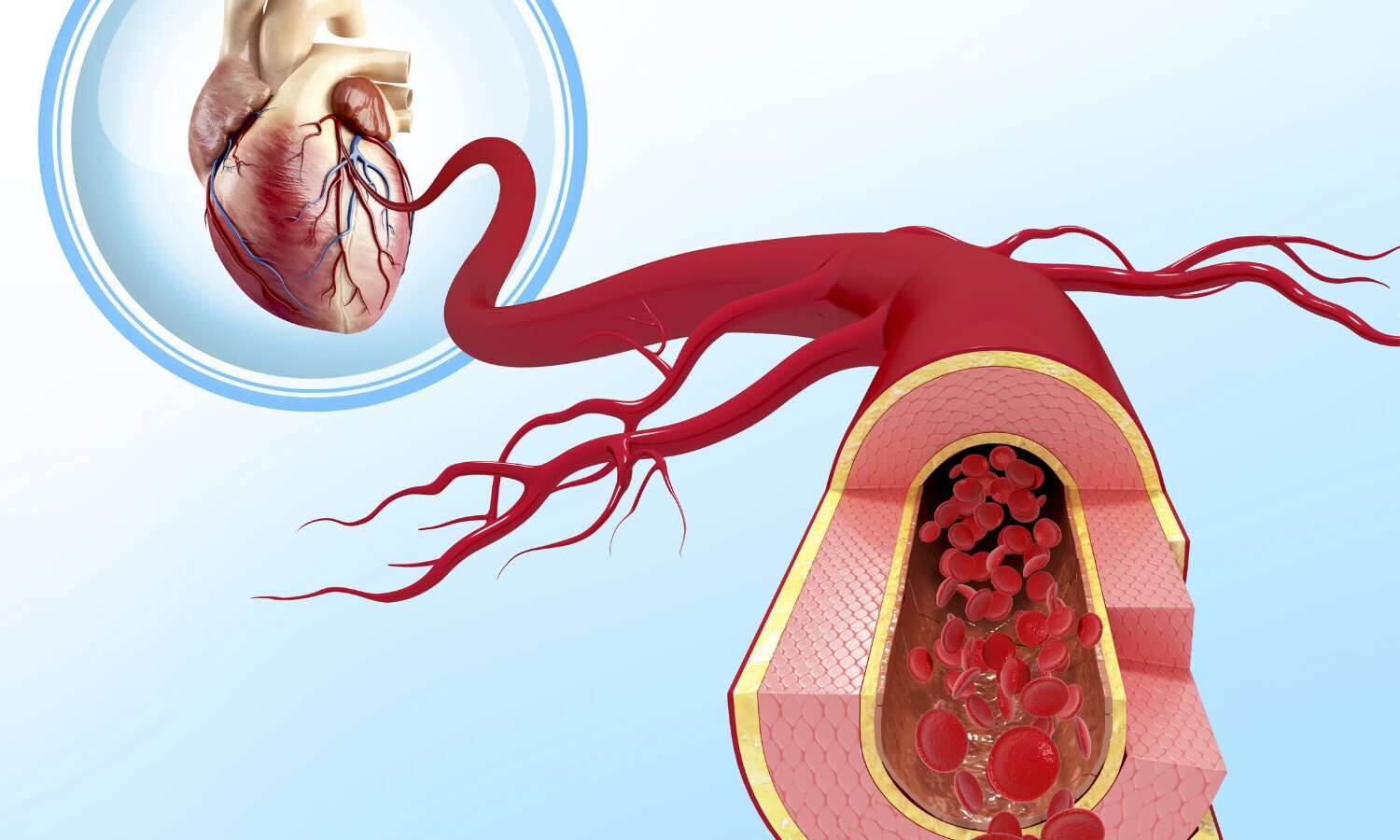 Routine heart CT scanning not warranted after stenting for left main CAD: ESC Study
