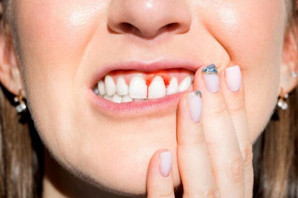 Mediterranean diet could reduce gum disease, reveals study