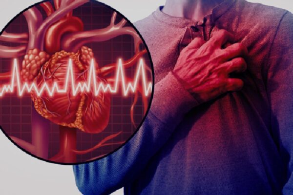 Women With Diabetes Face Higher Risk of Kidney Injury After Heart Attack, Study Finds