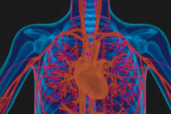 Study Links Metabolic Syndrome to Adverse Coronary Plaque Profiles in T2DM