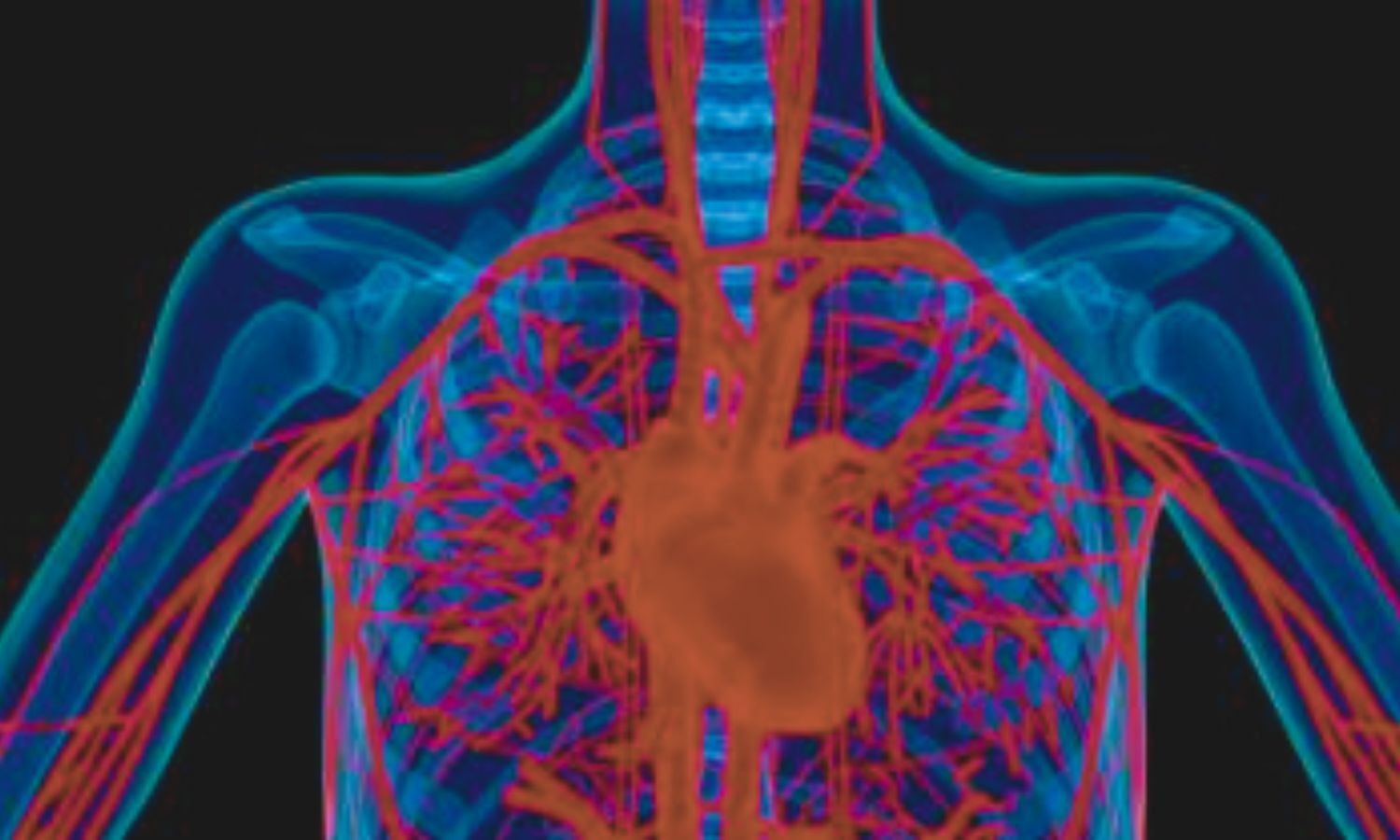 Study Links Metabolic Syndrome to Adverse Coronary Plaque Profiles in T2DM