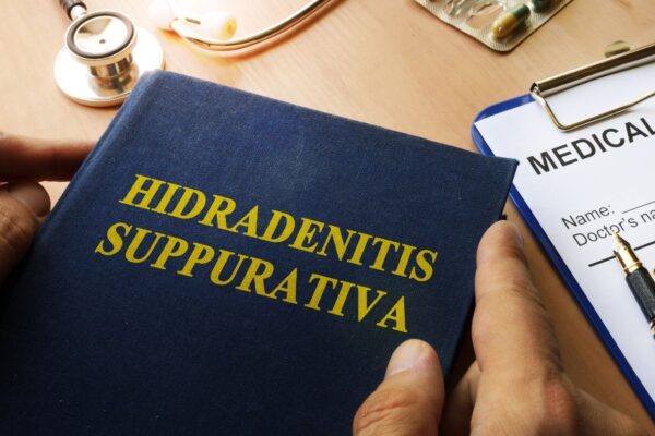 Hidradenitis Suppurativa Linked to Higher Risk of Serious Eye Diseases: Study