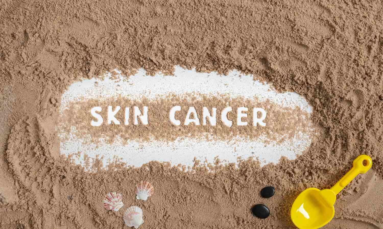 Elevated serum vitamin D levels are linked with higher skin cancer risk, finds study
