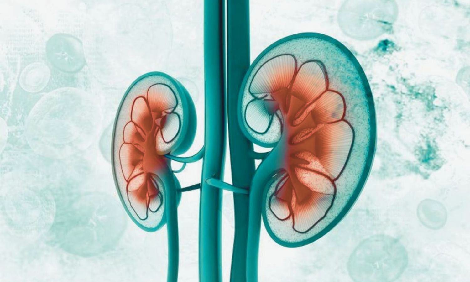 World’s first clinical trial showing lubiprostone aids kidney function, finds study