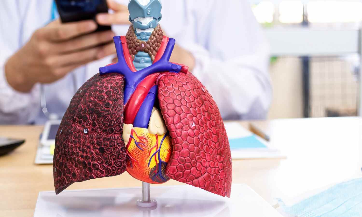 HF therapy guided by wearable devices effective in reducing mortality: Study